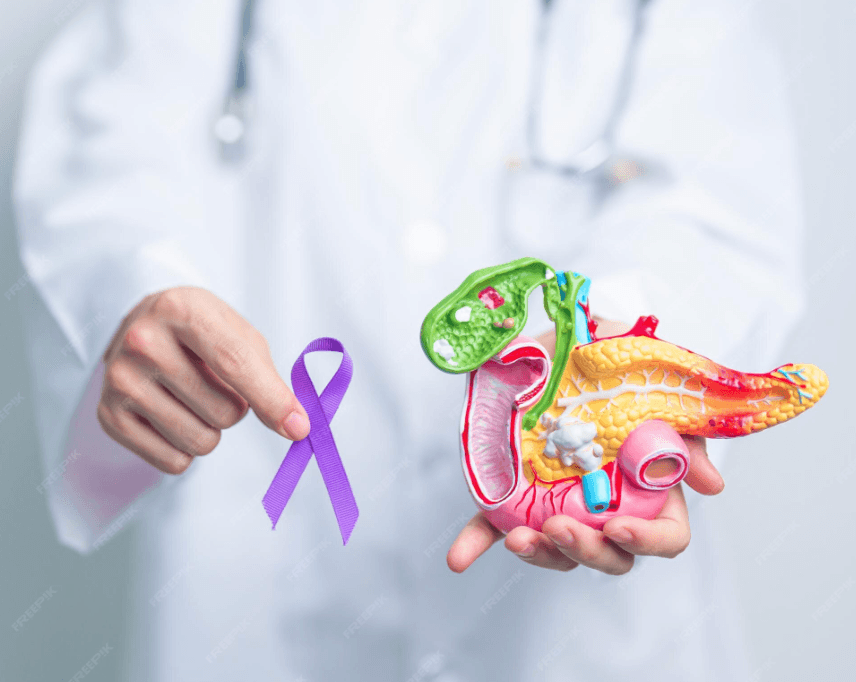 Рак поджелудочной железы