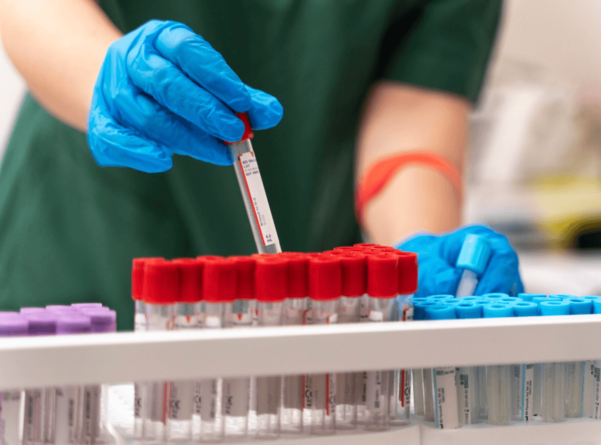 Топ-10 анализов, которые помогают выявить рак на ранней стадии