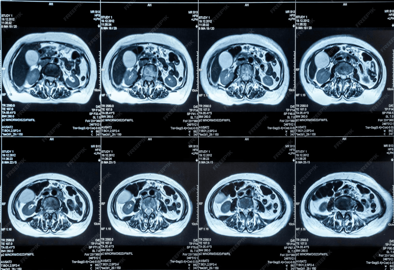 Как “увидеть” рак: виды визуализационных методов в онкологии